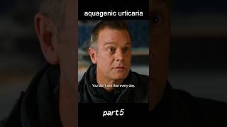 Aquagenic urticariaviral movie shorts [upl. by Aiam138]