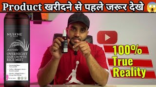 Nuskhe By Paras Hair Growth Spray Honest Review  Worth it or Not  100 Honest Review review [upl. by Fu]