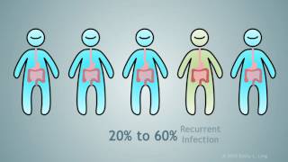 Fecal Microbial Transplantation A Treatment for Clostridium Difficile [upl. by Ava73]