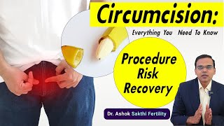 Circumference surgery  Procedure  Risk  Recovery [upl. by Euqinue]