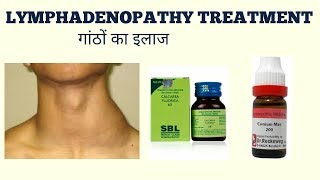 LYMPHADENOPATHY TREATMENTगांठों का ईलाज [upl. by Nnael154]