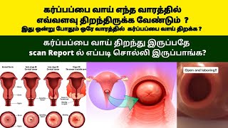 cervix dilation during pregnancy in tamil  Cervix dilation during pregnancy third trimester [upl. by Alvord]