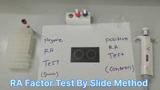 RA factor  A rheumatoid factor test By Slide Method [upl. by Kaule]