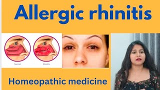 Allergic rhinitis treatment  Allergic rhinitis symptomscauses amp homeopathic medicine in hindi [upl. by Gypsie544]