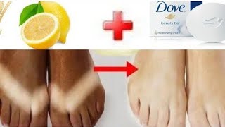 comment blanchir les pieds en 5 minutes éclaircir les pieds avec le savon dove et citron [upl. by Paehpos]