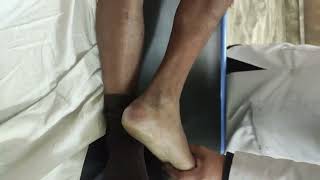 Ankle clonus [upl. by Adne]