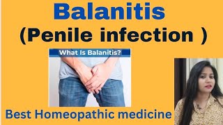 Balanitis  Penis infection treatment  Balanitis symptoms causes amp Homeopathic medicine hindi [upl. by Jo]