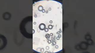 Dissolving Eno Under the Microscope 💥  Bubbling Reaction Revealed [upl. by Yentterb190]