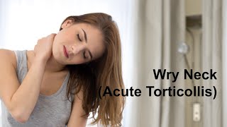 Wry Neck Acute Torticollis [upl. by Atilal]