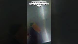 Haematology Practical Preparation of Peripheral Blood Smear in MBBS medico shorts [upl. by Nortal993]