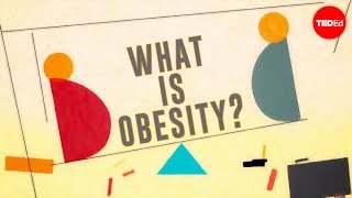 What is obesity  Mia Nacamulli [upl. by Teador759]