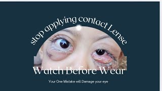 🔞Is It Safe To Wear Contact Lens🔞 Stop Doing These Mistakes 👁️❌contactlenses [upl. by Anayra]