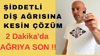 Şiddetli Diş Ağrısı Nasıl Geçer  2 dk da Diş Ağrısına Kesin Çözüm [upl. by Yanahs955]