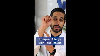 How to Understand Your Allergy Skin Test Results shorts [upl. by Stefan]