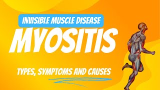 Myositis Types Symptoms and Causes [upl. by Vachell951]