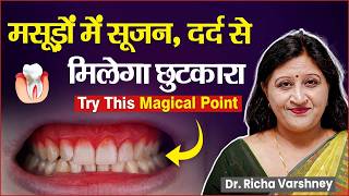 Gums Swelling Treatment at Home  Gingivitis Treatment [upl. by Orola]