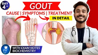 gout biochemistry  cause and symptom of gout  treatment of gout biochemistry [upl. by Ainesej]