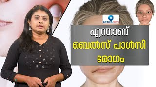 Bells Palsy  എന്താണ് ബെൽസ് പാൾസി രോഗം ആശങ്ക വേണ്ട  Mithun Ramesh  Zee Malayalam News [upl. by Ariaek]