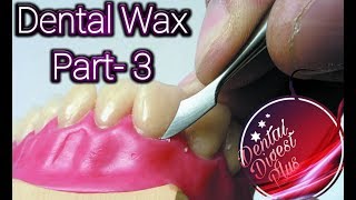 Dental wax part 3  waxes used in dentistry [upl. by Bodi]