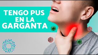 ¿Por Qué Sale PUS en la GARGANTA ⚪ Infección en Garganta con Pus [upl. by Branen]