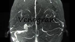 How to Pronounce Venogram [upl. by Web]