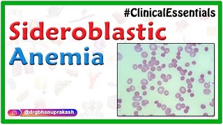 Sideroblastic Anemia  Causes Pathogenesis Clinical Presentation Diagnosis Treatment [upl. by Jarrid]