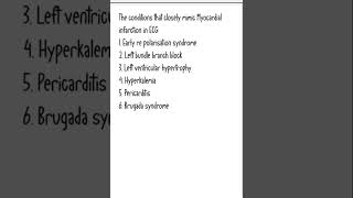 Norcet topic  MI in ECG [upl. by Arait]