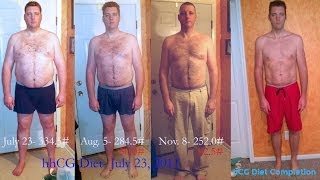 Guys hCG Diet Results for Men  110lb Weight Loss  Episode 9 hCG Diet Interviews [upl. by Kaitlynn]