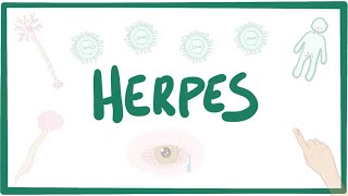 ðŸ¥¦Herpes simplexðŸ¥¦ [upl. by Medora]