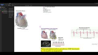 Oncological Emergencies Screen Recording 2023 10 27 at 3 15 20 PM [upl. by Fidole208]