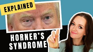 Horners Syndrome Explained Whiteboard Tutorial with Donald Trump [upl. by Devin]