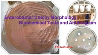 Enterobacter Colony Morphology Biochemical Tests and Antibiogram Demonstration [upl. by Oirramaj342]