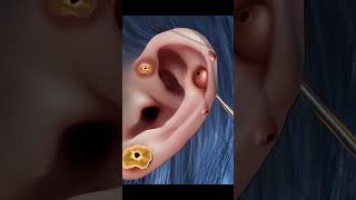 ASMR Remove Unmanned Ear Piercing  Helix Lobe Ear Ring Cleaning shorts earcleaning asmr relax [upl. by Prudie]