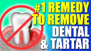 1 Remedy to Remove Dental Plaque amp Tarter [upl. by Litch99]