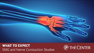 What to Expect During Nerve Conduction Studies and EMG Tests [upl. by Garibald]