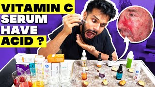 Testing The Best Vitamin C Serum For Indian Skin Shocking Result  BeYourBest Skincare San Kalra​ [upl. by Dunseath]