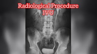 IVU  IVP Procedure  Radiology Procedure  Radiographer  Rso [upl. by Aicilec]