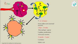 Cerebrovascular diseases [upl. by Rana]