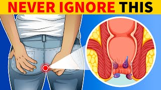 6 Signs of Colon Cancer You Should Know [upl. by Kermie118]