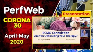 ECMO Cannulation – Are you optimizing your therapy [upl. by Denney183]