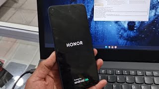 Eliminar cuenta Google FRP Honor 50 Lite NTNLX3 ➡️✅️ Sigma [upl. by Anitsrihc]