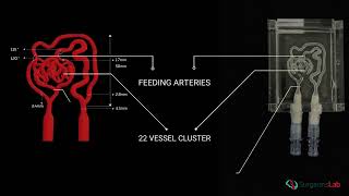 Optimizing AVM Treatment Simulation Training for Radiologists  SurgeonsLab AG [upl. by Scharaga651]