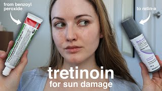 Does Tretinoin RetinA Help With Sun Spots Damage amp Melasma My 4Month Results [upl. by Beattie283]