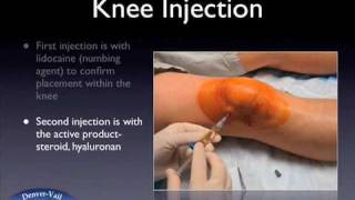 Knee injection web [upl. by Imeka]