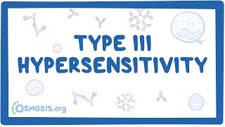 Type III hypersensitivity immune complex mediated  causes symptoms amp pathology [upl. by Eenahc187]