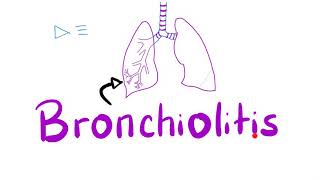 Acute Bronchiolitis Bronchiolitis ObliteransOrganizing Pneumonia BOOP  Pulmonology [upl. by Fechter]