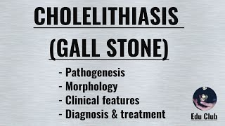 Cholelithiasis Gall Stone  Cholesterol stone  Pigment stone [upl. by Ecyal305]