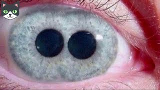 5 INCREÍBLES OJOS HUMANOS QUE NO CREERÁS QUE EXISTEN  OJOS UNICOS EN EL MUNDO [upl. by Rebmit824]