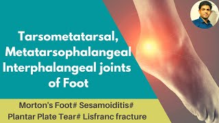 TARSOMETATARSAL  MTP  IP JOINTS OF FOOT COMPLEX Mortons foot Lisfranc fractureAnkle Series 4 [upl. by Willms276]