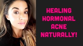 Clearing Hormonal Acne Naturally  LLysine for Acne [upl. by Alrak]